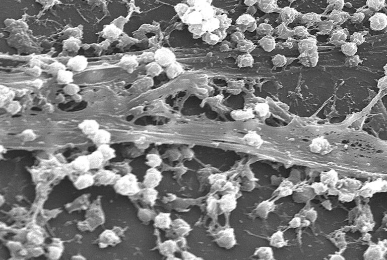Elektronenmikroskopische Aufnahme eines bakteriellen Biofilms auf einer Katheteroberfläche, CDC; keine Aufnahme aus Marburg.